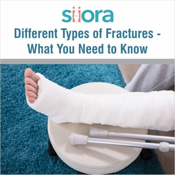 Different Types of Fractures - What You Need to Know - Siora Surgicals ...