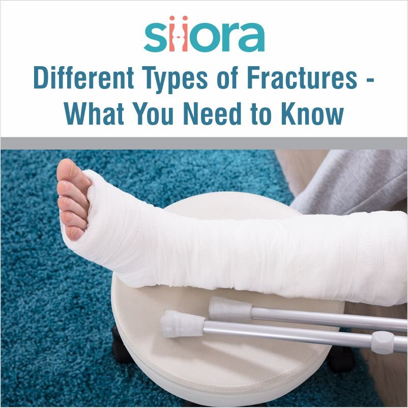 Read more about the article Different Types of Fractures – What You Need to Know