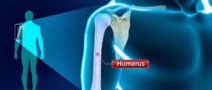 Management of the Closed Fracture of the Humerus