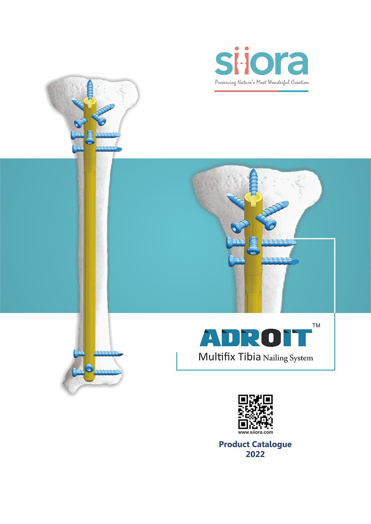 adroit multifix tibia nailing system