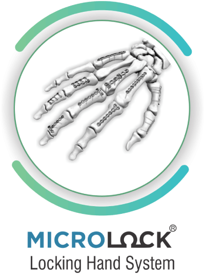 microlock locking hand system