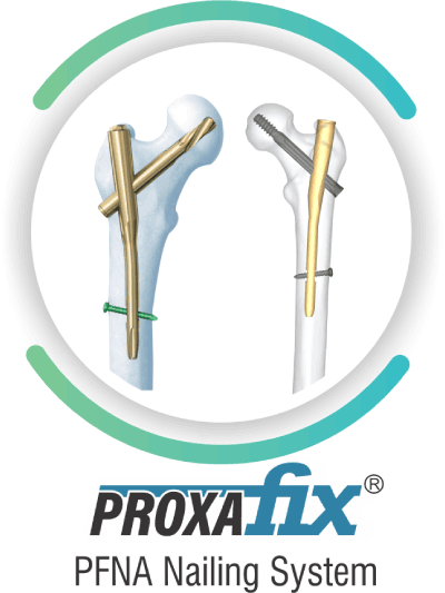 proxafix pfna nailing system