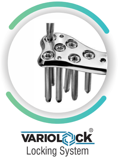 variolock locking system