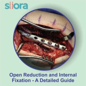 Open reduction and internal fixation