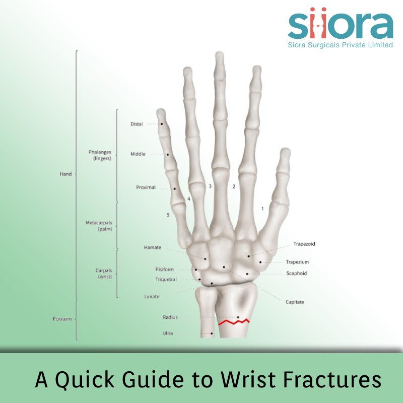 Read more about the article A Quick Guide to Wrist Fractures