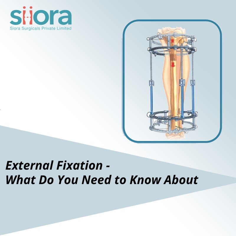 External Fixation - What Do You Need to Know About