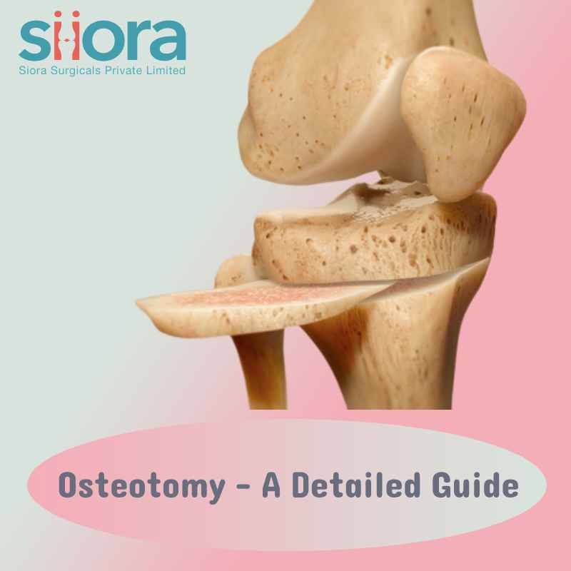 Read more about the article Osteotomy – A Detailed Guide