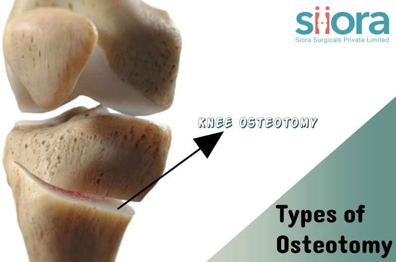 Types of Osteotomy