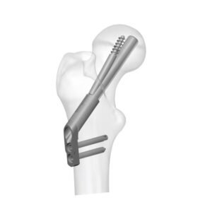 Femoral Neck System