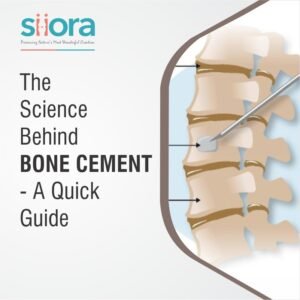 The Science Behind Bone Cement - A Quick Guide