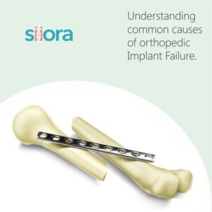 Failure of Orthopedic Implant