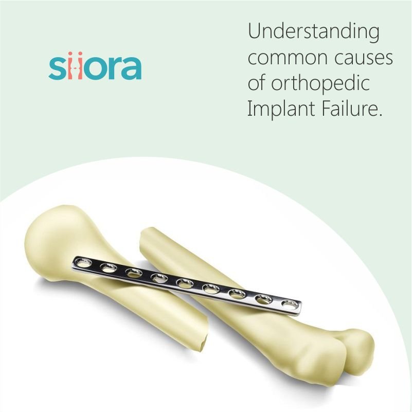 Failure of Orthopedic Implant