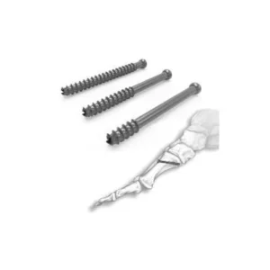 Cannulated Screws