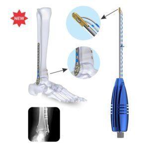 Flex Rope for Syndesmosis Repair, titanium – Sterile