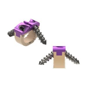 ACDF Standalone Cage PRO 0° Deg. Taper – Peek (Sterile)