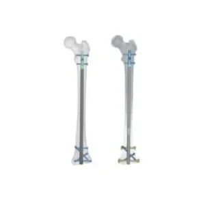 Rigifix Multilock Retrograde Femoral Nail