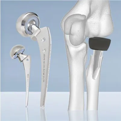 Prothesis front