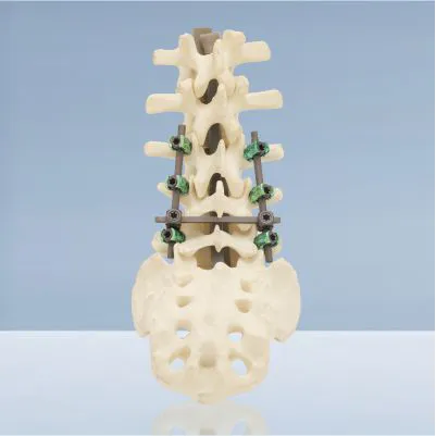 Spine System Front